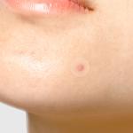 [TIAM] Surprise H Patch (18 Count, Pack of 1) 5