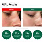[Dr.G] Red Blemish Clear Soothing Cream 70ml 7