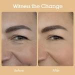 [Blithe] Vital Treatment 8 Nourishing Beans 150ml 6