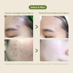 [Blithe] Patting Splash Mask Soothing & Healing Green Tea 150ml 8