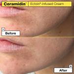 [Dr.Jart+] Ceramidin Ectoin-Infused Cream 50ml 4