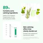 [Somebymi] AHA BHA PHA 30 Days Miracle Miracle Serum Light 50ml 6