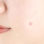 [PyunkangYul] Clear Spot Patch 72ea 3