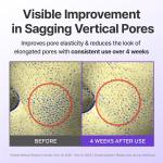 [Centellian24] Madeca TECA RETINOLSOM 0.2 Firming Serum 30ml 5