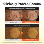 [Centellian24] Madeca Vitamin 15+ Glowing Serum 30ml 5