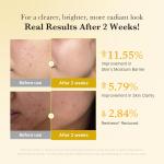 [Medicube] Kojic Acid Turmeric Niacinamide Serum 30ml 4