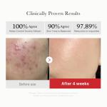 [Medicube] Red Succinic Acid Peeling Pads 70pcs 4