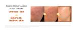 [SUNGBOON EDITOR] Kojic Acid Niacinamide Brightening Ampoule 35ml 6